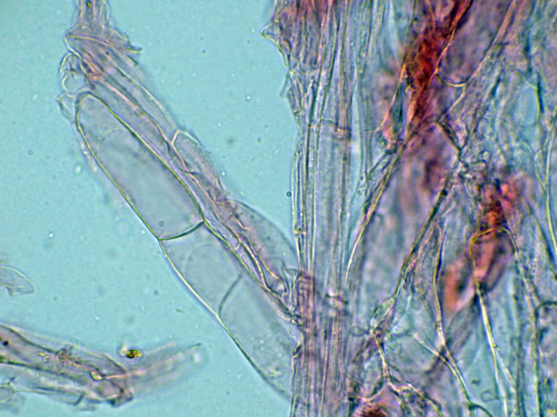 Microscopía de Rickenella mellea - 10 - Cutícula-004